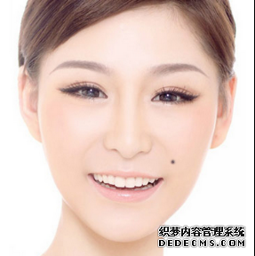 脸上痣的位置 不同位置有不同的寓意.png
