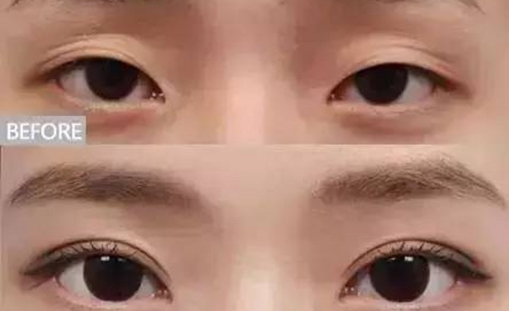 攻略: 化妆师必学专业技巧：遇到肿泡眼新娘千万